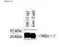 Fig. 08 - Methods of detecting therapeutic exosomes