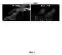 Fig. 02 - Recombinant C7 and Methods of Use