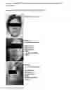 Fig. 07 - MODULATORS AND METHODS FOR THE TREATMENT OF ROSACEA