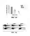 Fig. 04 - METHODS FOR TREATMENT OF MELANOMA