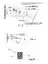 Fig. 02 - Biodegradable intravitreal tyrosine kinase implants