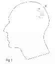 Fig. 02 - Implantable system enabling responsive therapy for pain