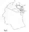 Fig. 03 - Implantable system enabling responsive therapy for pain