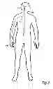 Fig. 06 - Implantable system enabling responsive therapy for pain