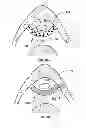 Fig. 07 - Surgical slings
