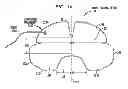 Fig. 02 - BOWEL PACKING DEVICE HAVING A TETHER