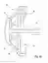 Fig. 07 - Minimally invasive laparoscopic retractor