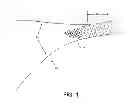 Fig. 02 - Methods and apparatus for determining fallopian tube occlusion