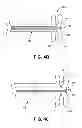 Fig. 09 - Methods and apparatus for determining fallopian tube occlusion