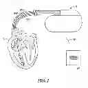 Fig. 02 - HEART FAILURE PATIENTS STRATIFICATION