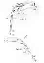 Fig. 16 - Stabilization system and aspiration device with rapid diagnostics