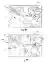 Fig. 05 - Efficient and interactive bleeding detection in a surgical system