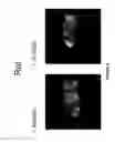 Fig. 07 - Novel Needle Driver For Magnetic Resonance Elastography