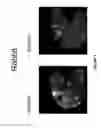 Fig. 08 - Novel Needle Driver For Magnetic Resonance Elastography
