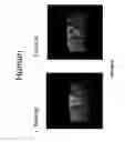 Fig. 09 - Novel Needle Driver For Magnetic Resonance Elastography
