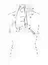 Fig. 01 - System and methods for controlling retrograde carotid arterial blood flow