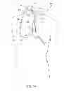 Fig. 02 - System and methods for controlling retrograde carotid arterial blood flow