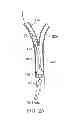 Fig. 06 - System and methods for controlling retrograde carotid arterial blood flow