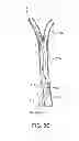 Fig. 08 - System and methods for controlling retrograde carotid arterial blood flow