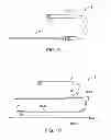 Fig. 14 - System and methods for controlling retrograde carotid arterial blood flow