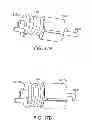 Fig. 19 - System and methods for controlling retrograde carotid arterial blood flow