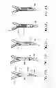 Fig. 23 - System and methods for controlling retrograde carotid arterial blood flow