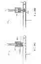 Fig. 26 - System and methods for controlling retrograde carotid arterial blood flow