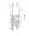 Fig. 30 - System and methods for controlling retrograde carotid arterial blood flow