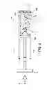 Fig. 04 - Securement for a surgical site marker and deployment device for same