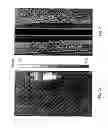 Fig. 03 - Three-Dimensional Tissue Hardness Imaging