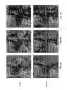 Fig. 04 - Three-Dimensional Tissue Hardness Imaging