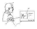 Fig. 01 - System and method for improved complex fractionated electrogram ablation