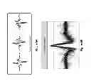 Fig. 07 - System and method for improved complex fractionated electrogram ablation