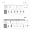 Fig. 03 - Apparatus and method for identifying myocardial ischemia using analysis of high frequency QRS potentials