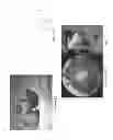 Fig. 09 - COIL ELECTRODE APPARATUS FOR THERMAL THERAPY FOR TREATING BONE TISSUE