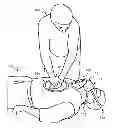 Fig. 01 - Method and Apparatus for Improved Ventilation and Cardio-Pulmonary Resuscitation