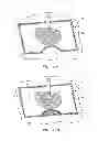 Fig. 10 - Modifiable occlusive skin dressing