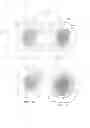 Fig. 19 - Modifiable occlusive skin dressing