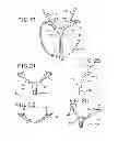 Fig. 10 - Oral mouthpiece and method for the use thereof