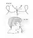 Fig. 16 - Oral mouthpiece and method for the use thereof