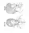 Fig. 17 - Oral mouthpiece and method for the use thereof