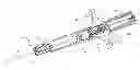 Fig. 01 - Catheter placement device and method