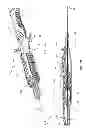Fig. 02 - Catheter placement device and method