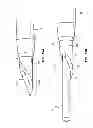 Fig. 32 - Catheter placement device and method