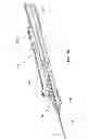 Fig. 35 - Catheter placement device and method