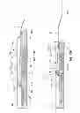 Fig. 40 - Catheter placement device and method