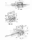 Fig. 44 - Catheter placement device and method
