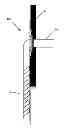 Fig. 01 - THORACOSTOMY DEVICES AND METHODS OF USE
