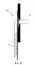 Fig. 04 - THORACOSTOMY DEVICES AND METHODS OF USE