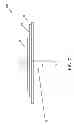 Fig. 13 - THORACOSTOMY DEVICES AND METHODS OF USE
